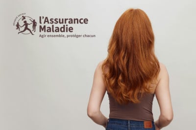 Remboursement prothèse capillaire : les nouvelles règles de la Sécurité sociale
