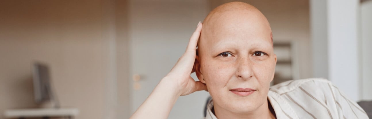 Alopécie : définition simple et causes de la perte de cheveux