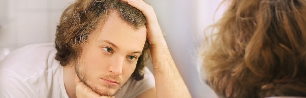comment cacher une calvitie naturellement
