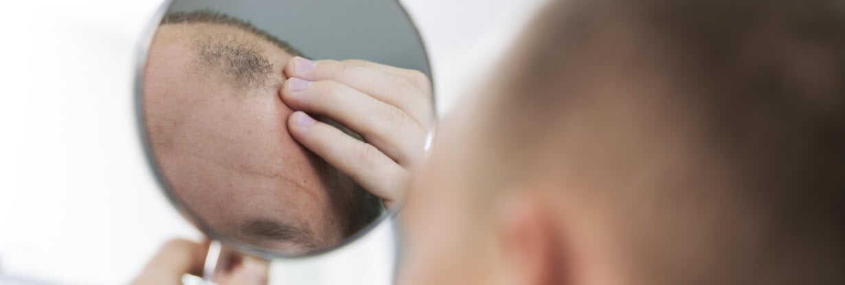 Welche Erkrankungen können Haarausfall verursachen?