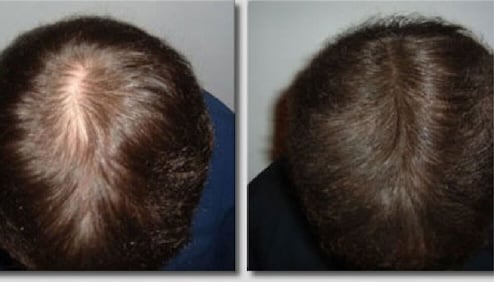 Poudre pour cheveux pour femme pour cacher la perte de cheveux