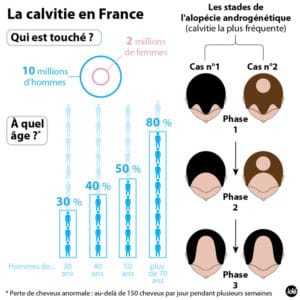 Schéma de la calvitie en France