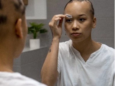 Comprendre la perte de cheveux