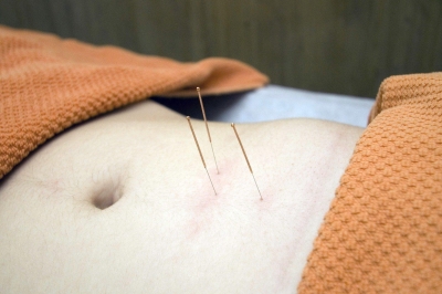 L'acupuncture, remède pour soigner les effets secondaires liés au traitement du 