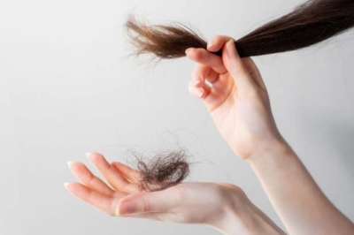 Calvitie et alopécie : un mal-être à ne pas mésestimer